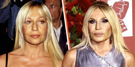 donatella versace chirurgia|Donatella Versace before and after.